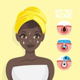 Tratamiento del acné con la mascarilla Idea de la belleza libre illustration Tratamiento del acné con la mascarilla Idea de la belleza libre illustration