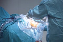 Traumatology orthopedic surgery knee arthroscopy royalty free stock images Traumatology orthopedic surgery knee arthroscopy royalty free stock images