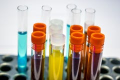 Tubes colorés d'essai en laboratoire, analyses de sang de biochimie, analyse d'urine, tube à essai, analyse médicale, concept de Image stock Tubes colorés d'essai en laboratoire, analyses de sang de biochimie, analyse d'urine, tube à essai, analyse médicale, concept de Image stock