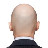 Tête chauve d'homme image stock Tête chauve d'homme image stock