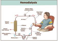 tła hemodialysis niedomiar odizolowywał procedura biel nerkowego używać Używać dla nerkowego niedomiaru ilustracji tła hemodialysis niedomiar odizolowywał procedura biel nerkowego używać Używać dla nerkowego niedomiaru ilustracji