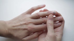Uma equimose no prego doente Acidente da fábrica Prego danificado insalubre do dedo A menina verifica a anomalia da unha sobre video estoque Uma equimose no prego doente Acidente da fábrica Prego danificado insalubre do dedo A menina verifica a anomalia da unha sobre video estoque