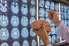 Un neurocirujano que lleva a cabo el modelo del cerebro y que señala en el cerebro MRI imagen de archivo Un neurocirujano que lleva a cabo el modelo del cerebro y que señala en el cerebro MRI imagen de archivo