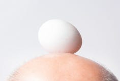 Uomo calvo su un fondo bianco, uomo calvizia con un uovo sul suo concetto capo di calvizile Fotografia Stock Uomo calvo su un fondo bianco, uomo calvizia con un uovo sul suo concetto capo di calvizile Fotografia Stock
