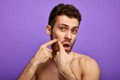 Uomo divertente che seleziona il brufolo sulla sua guancia fotografia stock Uomo divertente che seleziona il brufolo sulla sua guancia fotografia stock