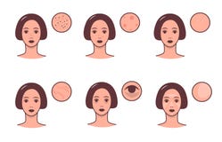 Uppsättningen av kvinnlign vänder mot med olikt hudvillkor och problem Skincare och dermatologibegrepp Färgrik vektor royaltyfri illustrationer Uppsättningen av kvinnlign vänder mot med olikt hudvillkor och problem Skincare och dermatologibegrepp Färgrik vektor royaltyfri illustrationer