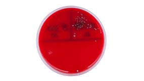 What causes enterococcus?