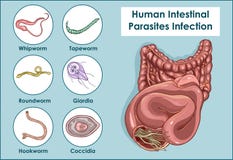 Vector Illustration of a Human Intestinal Parasites