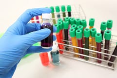 Vial or glass bottle with purple solvent or solution handle in hands wear nitrile blue gloves, with colorful cell culture tubes.