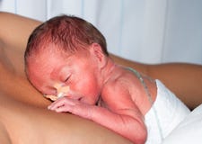 Voorbarige baby Stock Afbeelding Voorbarige baby Stock Afbeelding