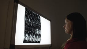 Vrouwelijke chirurgie arts die röntgenresultaten bij lichte monitor bekijken stock video Vrouwelijke chirurgie arts die röntgenresultaten bij lichte monitor bekijken stock video