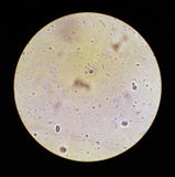Vue dans le microscope sur Trichomonas DST images stock Vue dans le microscope sur Trichomonas DST images stock