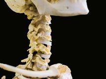 A vértebra cervical articulada desossa mostrar a anatomia humana do pescoço no fundo preto isolado com espaço para o texto foto de stock royalty free A vértebra cervical articulada desossa mostrar a anatomia humana do pescoço no fundo preto isolado com espaço para o texto foto de stock royalty free