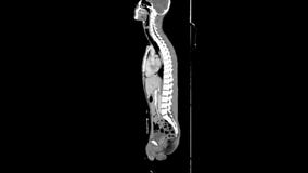 Whole Body CT / MRI scan, sagittal plane