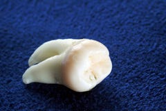 Wisdom Tooth royalty free stock image Wisdom Tooth royalty free stock image