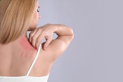 Woman with allergy symptoms scratching shoulder on grey background. Space for text stock images Woman with allergy symptoms scratching shoulder on grey background. Space for text stock images