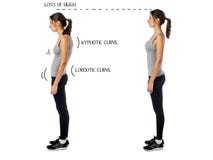 Woman with impaired posture position defect