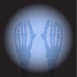 X ray feet. stock illustration X ray feet. stock illustration