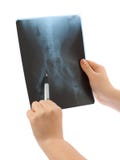 X-ray In Hands Royalty Free Stock Photo