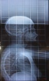 X-ray of a young female spine stock image X-ray of a young female spine stock image