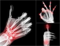 Xray obrazy stock Xray obrazy stock
