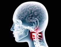 Xray of a womans scull on black with clipping path stock illustration Xray of a womans scull on black with clipping path stock illustration