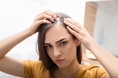 Young woman with hair loss problem