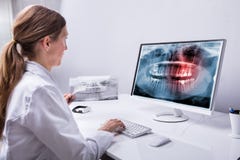 Zahnarzt-Looking At Teeth-Röntgenstrahl auf Computer stockbilder Zahnarzt-Looking At Teeth-Röntgenstrahl auf Computer stockbilder
