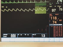 Монитор показателей жизненно важных функций показывая ECG пациента, форму волны ИМПа ульс oximetry, кровяное давление и другие по стоковые фото Монитор показателей жизненно важных функций показывая ECG пациента, форму волны ИМПа ульс oximetry, кровяное давление и другие по стоковые фото