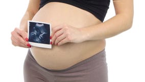 Έγκυος γυναίκα που κρατά μια ανίχνευση υπερήχου του μωρού της, λευκό, κινηματογράφηση σε πρώτο πλάνο απόθεμα βίντεο Έγκυος γυναίκα που κρατά μια ανίχνευση υπερήχου του μωρού της, λευκό, κινηματογράφηση σε πρώτο πλάνο απόθεμα βίντεο