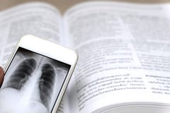 Ακτίνα X στο smartphone στοκ φωτογραφία με δικαίωμα ελεύθερης χρήσης Ακτίνα X στο smartphone στοκ φωτογραφία με δικαίωμα ελεύθερης χρήσης