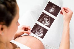 Ανίχνευση υπερήχου μωρών αναθεώρησης εγκύων γυναικών στοκ εικόνα Ανίχνευση υπερήχου μωρών αναθεώρησης εγκύων γυναικών στοκ εικόνα