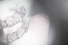 Αόρατο οδοντικό orthodontics στο χρωματισμένο υπόβαθρο στοκ φωτογραφία με δικαίωμα ελεύθερης χρήσης Αόρατο οδοντικό orthodontics στο χρωματισμένο υπόβαθρο στοκ φωτογραφία με δικαίωμα ελεύθερης χρήσης