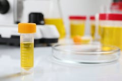 Εμπορευματοκιβώτιο με το δείγμα ούρων στον πίνακα στο εργαστήριο, διάστημα για το κείμενο στοκ φωτογραφίες Εμπορευματοκιβώτιο με το δείγμα ούρων στον πίνακα στο εργαστήριο, διάστημα για το κείμενο στοκ φωτογραφίες