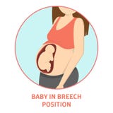 Ιατρικοί λόγοι για τη cesarean παράδοση ή το γ-τμήμα διανυσματική απεικόνιση Ιατρικοί λόγοι για τη cesarean παράδοση ή το γ-τμήμα διανυσματική απεικόνιση