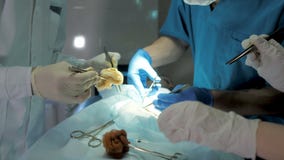Κλείστε επάνω τη λεπτομέρεια μιας χειρουργικής επέμβασης απόθεμα βίντεο Κλείστε επάνω τη λεπτομέρεια μιας χειρουργικής επέμβασης απόθεμα βίντεο