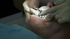 Ο θηλυκός οδοντίατρος με έναν βοηθό εξετάζει το στόμα του ασθενή ενός ατόμου ενός ηλικίας ατόμου Υψηλή βασική επαγγελματική εργασ απόθεμα βίντεο Ο θηλυκός οδοντίατρος με έναν βοηθό εξετάζει το στόμα του ασθενή ενός ατόμου ενός ηλικίας ατόμου Υψηλή βασική επαγγελματική εργασ απόθεμα βίντεο