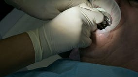 Ο θηλυκός οδοντίατρος με έναν βοηθό εξετάζει το στόμα του ασθενή ενός ατόμου ενός ηλικίας ατόμου Υψηλή βασική επαγγελματική εργασ απόθεμα βίντεο Ο θηλυκός οδοντίατρος με έναν βοηθό εξετάζει το στόμα του ασθενή ενός ατόμου ενός ηλικίας ατόμου Υψηλή βασική επαγγελματική εργασ απόθεμα βίντεο