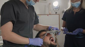Ο οδοντίατρος και το βοηθητικό πρόσωπο χρήσης του υποκύπτουν μεταχειριμένος τα υπομονετικά δόντια ` s Τοποθέτηση του ανώτερου σαγ απόθεμα βίντεο Ο οδοντίατρος και το βοηθητικό πρόσωπο χρήσης του υποκύπτουν μεταχειριμένος τα υπομονετικά δόντια ` s Τοποθέτηση του ανώτερου σαγ απόθεμα βίντεο