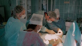 Ομάδα των χειρούργων στο στάδιο της ολοκλήρωσης της χειρουργικής επέμβασης reimplantation απόθεμα βίντεο Ομάδα των χειρούργων στο στάδιο της ολοκλήρωσης της χειρουργικής επέμβασης reimplantation απόθεμα βίντεο