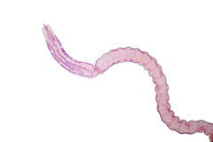 Παρασιτικό flatworm κεστοειδών σκωλήκων των βοοειδών και άλλου βόσκοντας ζώου στοκ εικόνα με δικαίωμα ελεύθερης χρήσης Παρασιτικό flatworm κεστοειδών σκωλήκων των βοοειδών και άλλου βόσκοντας ζώου στοκ εικόνα με δικαίωμα ελεύθερης χρήσης