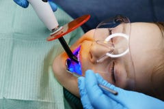 Πλήρωση των δοντιών γάλακτος κλινική οδοντική στοκ φωτογραφίες Πλήρωση των δοντιών γάλακτος κλινική οδοντική στοκ φωτογραφίες