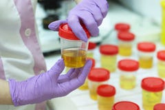 Προετοιμασία των δειγμάτων ούρων στο εργαστήριο στο νοσοκομείο για τη μελέτη Ειδικές λουρίδες δοκιμής για την εξέταση ούρων στοκ φωτογραφίες με δικαίωμα ελεύθερης χρήσης Προετοιμασία των δειγμάτων ούρων στο εργαστήριο στο νοσοκομείο για τη μελέτη Ειδικές λουρίδες δοκιμής για την εξέταση ούρων στοκ φωτογραφίες με δικαίωμα ελεύθερης χρήσης