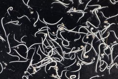 Аскаридоз заболевание причиненное паразитными lumbricoides Ascaris roundworm для образования стоковая фотография Аскаридоз заболевание причиненное паразитными lumbricoides Ascaris roundworm для образования стоковая фотография