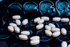 Белые фармацевтические таблетки медицины на магнитной предпосылке mri развертки резонанса мозга Тема фармации, здравоохранение стоковые фотографии rf Белые фармацевтические таблетки медицины на магнитной предпосылке mri развертки резонанса мозга Тема фармации, здравоохранение стоковые фотографии rf
