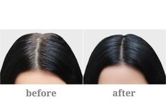 Голова девушки с черными серыми волосами Расцветка волос Before and after стоковые фото Голова девушки с черными серыми волосами Расцветка волос Before and after стоковые фото