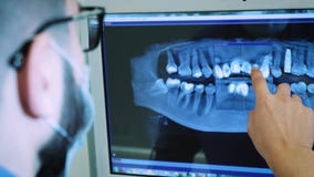Дантист изучает изображение рентгеновского снимка 3D челюсти акции видеоматериалы Дантист изучает изображение рентгеновского снимка 3D челюсти акции видеоматериалы