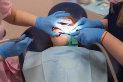 Дантист обрабатывает зубы child’s Здоровье и красота зубов стоковое изображение rf Дантист обрабатывает зубы child’s Здоровье и красота зубов стоковое изображение rf