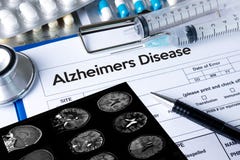 Концепция заболеванием Alzheimers, заболевания Parkin мозга вырожденческие стоковые фотографии rf Концепция заболеванием Alzheimers, заболевания Parkin мозга вырожденческие стоковые фотографии rf