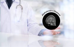 Концепция заболеванием Alzheimers, заболевания Parkin мозга вырожденческие стоковое изображение rf Концепция заболеванием Alzheimers, заболевания Parkin мозга вырожденческие стоковое изображение rf